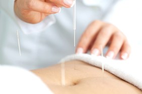 acupuncture for fertility